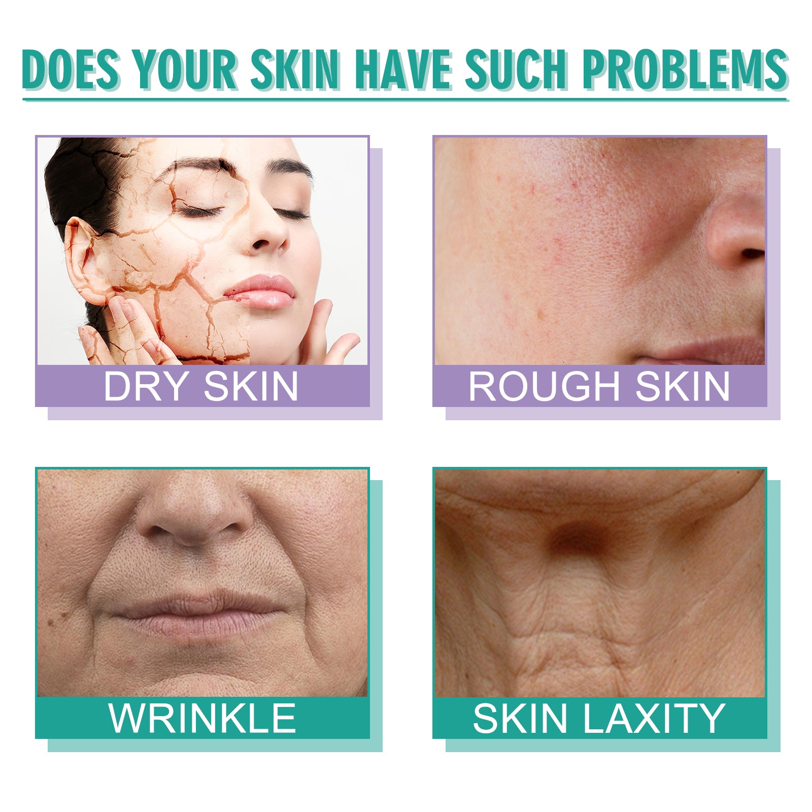 Moisturizing Skin Care Cream To Reduce Dark Spots, Fine Lines, Anti-Wrinkle Moisturizing, Whitening, Firming And Replenishing Surface Cream