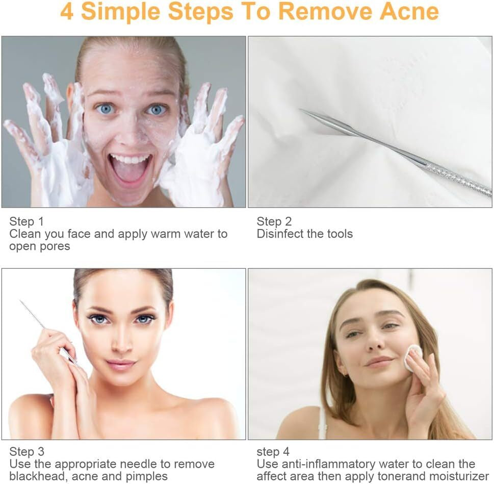 9 PCS Blackhead Remover & Pimple Popper Tool Kit with Stainless Steel Tweezers &